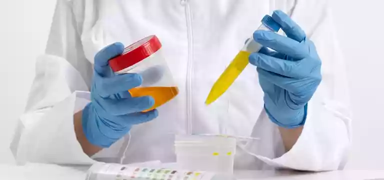 Urinalysis Tests: Urine RE/ME test, Urine R/M test